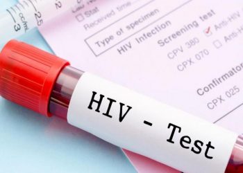 Dituduh Mengidap HIV, Bagaimana Cara Kita Mengetahui Pengindap HIV ?