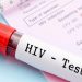 Dituduh Mengidap HIV, Bagaimana Cara Kita Mengetahui Pengindap HIV ?