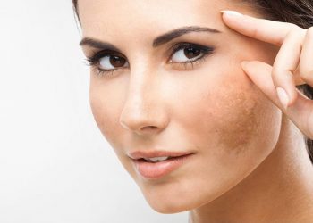 Yuk Intip ! 5 Masker Alami Untuk Hilangkan Flek Hitam Di Wajah