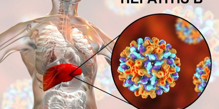 Gejala Hepatitis B yang Pantang Disepelekan