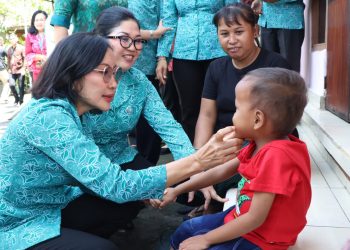 Cek Langsung Gigi Balita, Ny. drg. Ida Mahendra Jaya Ingatkan Orangtua Larang Anak Konsumsi Makanan Mengandung Gula Berlebih