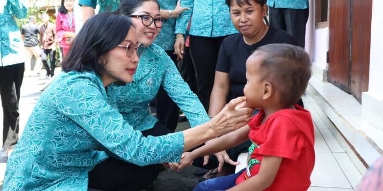 Cek Langsung Gigi Balita, Ny. drg. Ida Mahendra Jaya Ingatkan Orangtua Larang Anak Konsumsi Makanan Mengandung Gula Berlebih